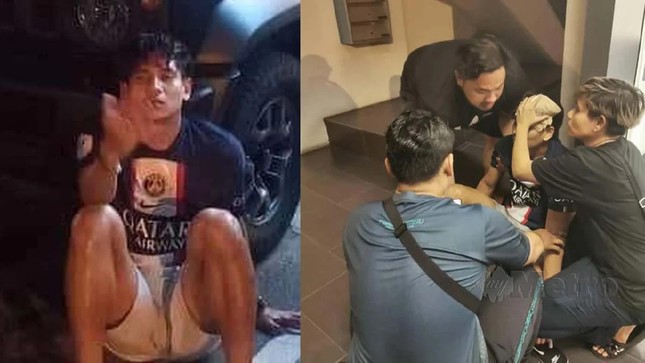 Hai cầu thủ đội tuyển Malaysia bị tạt axit, hình ảnh khiến nhiều người rùng mình